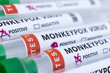 New mpox detection kit approved for market use