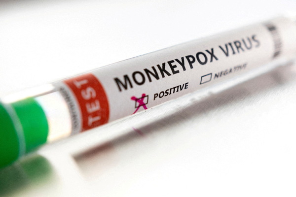 106 monkeypox cases reported