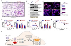 XJTU Joint Research Team of First Affiliated Hospital and Health Science Center Discovers Key Mechanism in SARS-CoV-2-induced Damage to Vascellum