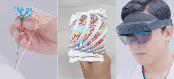 AI-powered innovation boosts Pudong's advanced medical devices