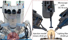 Chinese researchers develop eye surgery robot